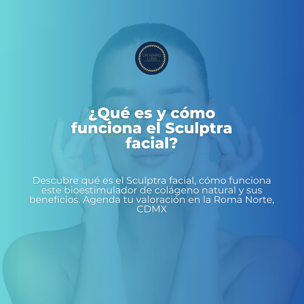 ¿Qué es y cómo funciona el Sculptra facial? ¿Qué es y cómo funciona el Sculptra facial?