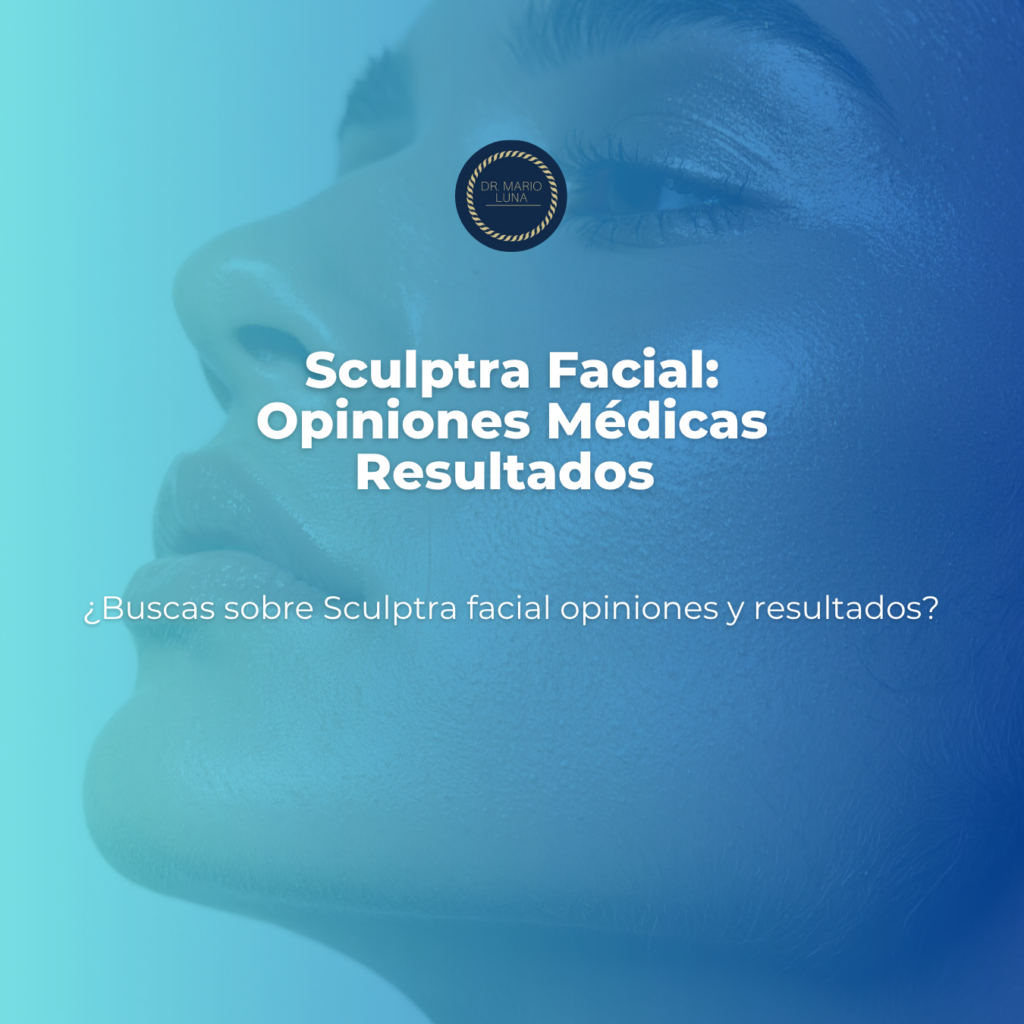 sculptra facial opiniones