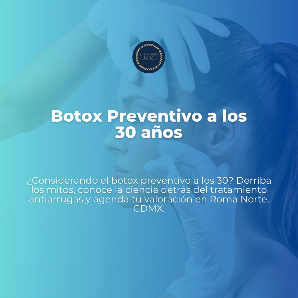 botox preventivo