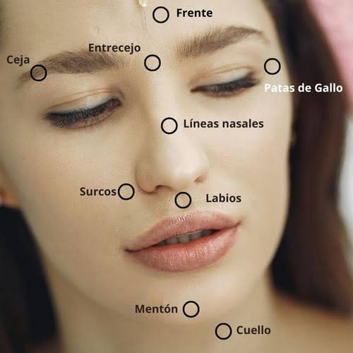 resultados de sculptra